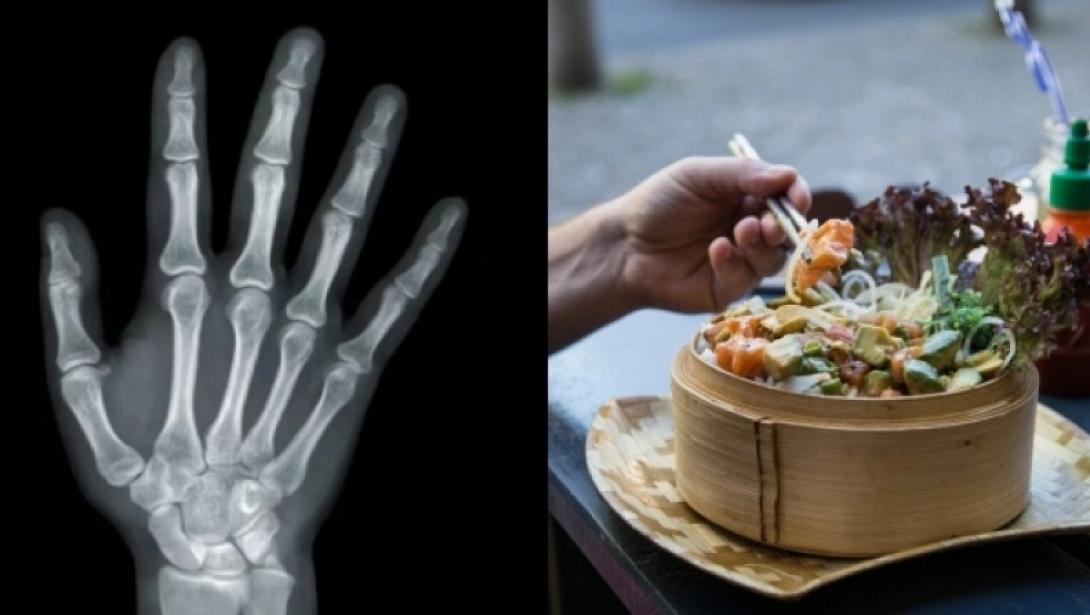 βακτηριδιακή λοίμωξη