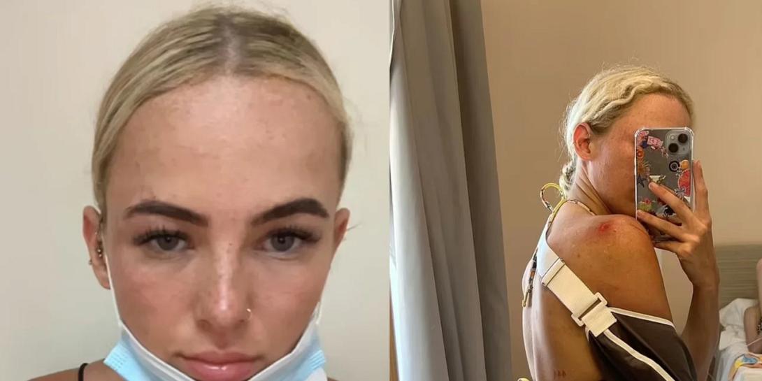 τουρίστρια γουρούνα