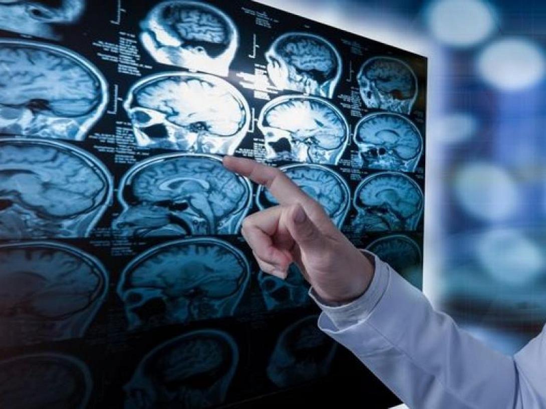 ΣΚΛΗΡΥΝΣΗ ΚΑΤΑ ΠΛΑΚΑΣ