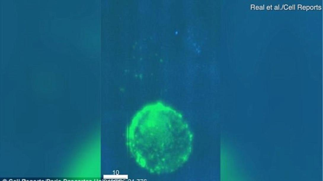 μολυσμένο κύτταρο aids