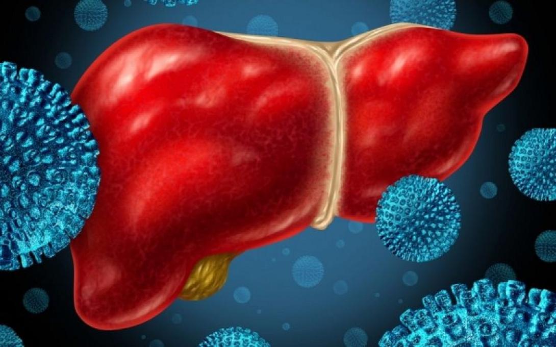 ηπατίτιδα