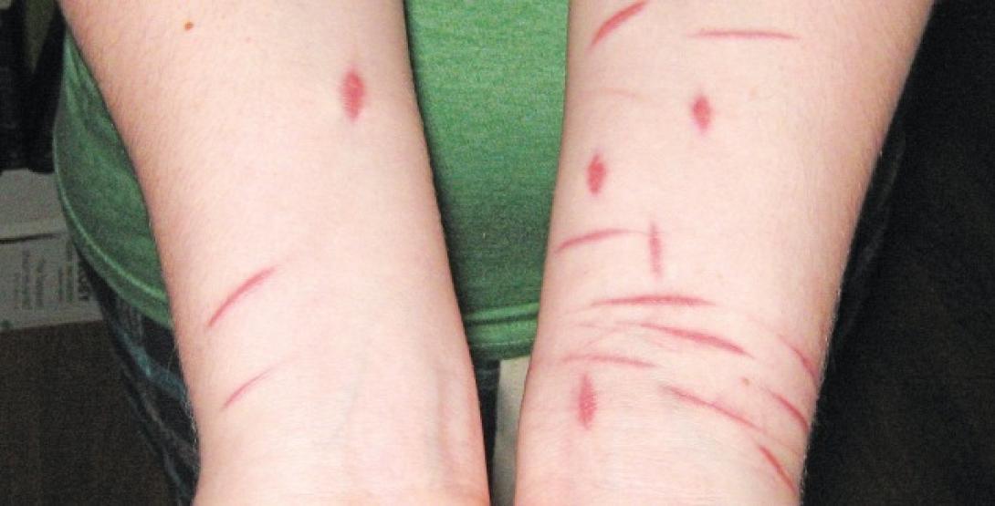 παιδια χαρακιες