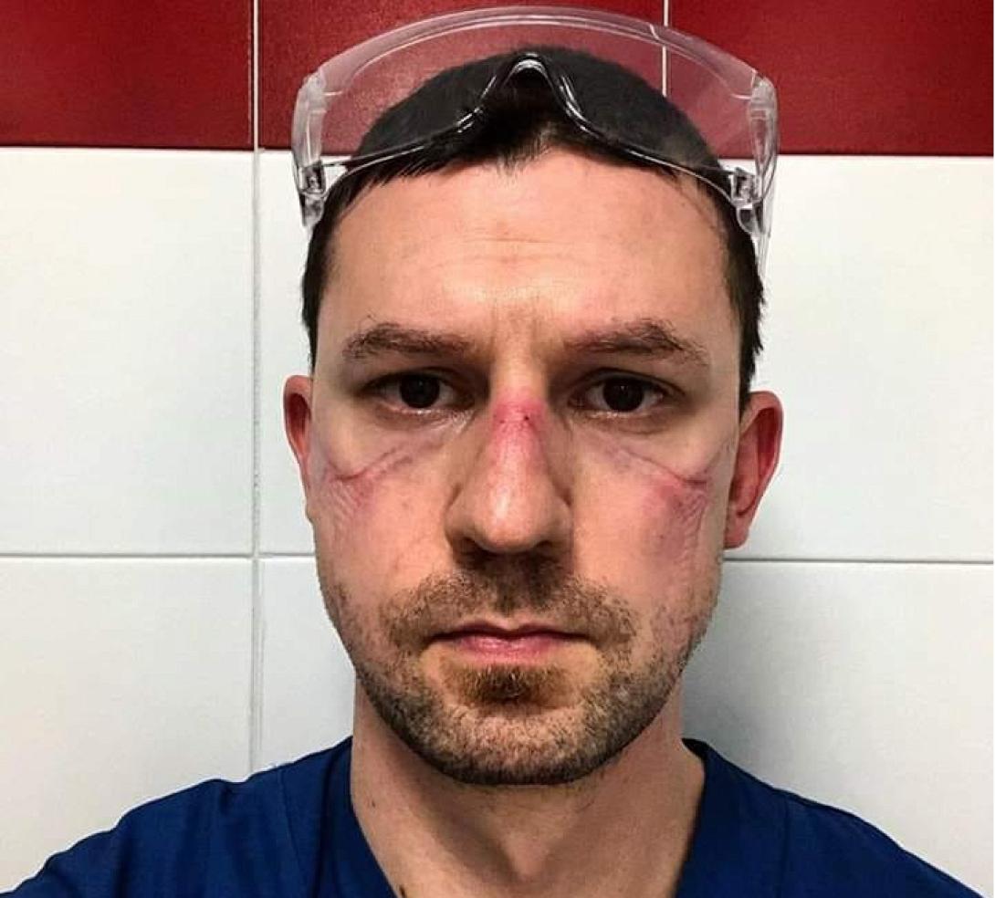 Νικόλα Sgarbi' - μετα απο 13 ώρες εντατική