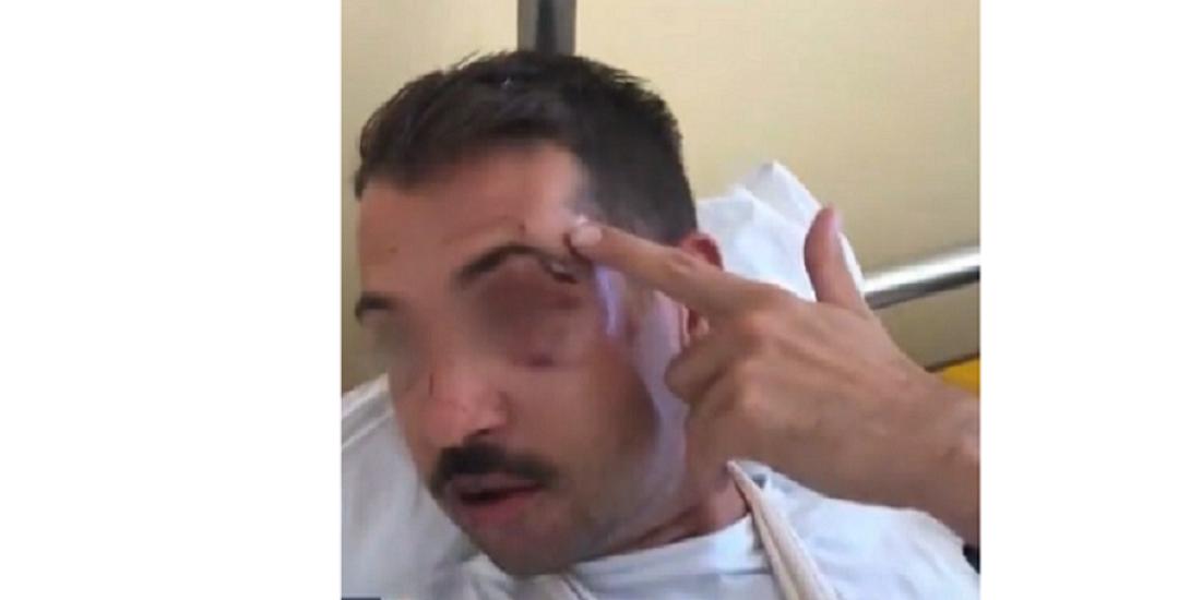 ξυλοδαρμός