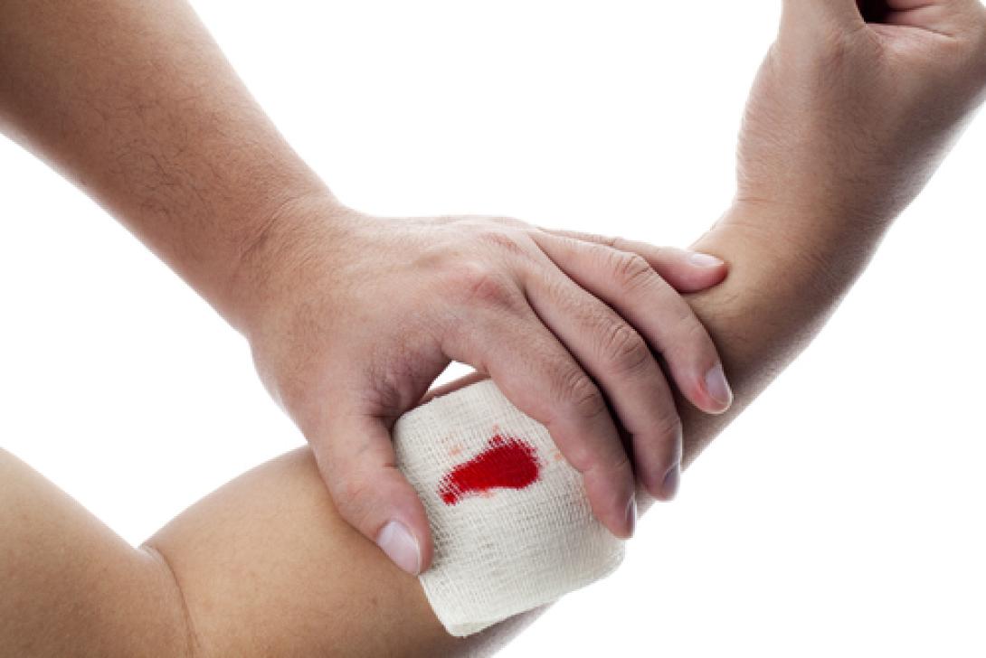 Αιμορραγια