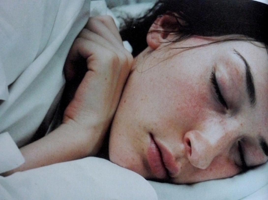 Ακμή: Απαλλαγείτε με τη βοήθεια του νυχτολούλουδου