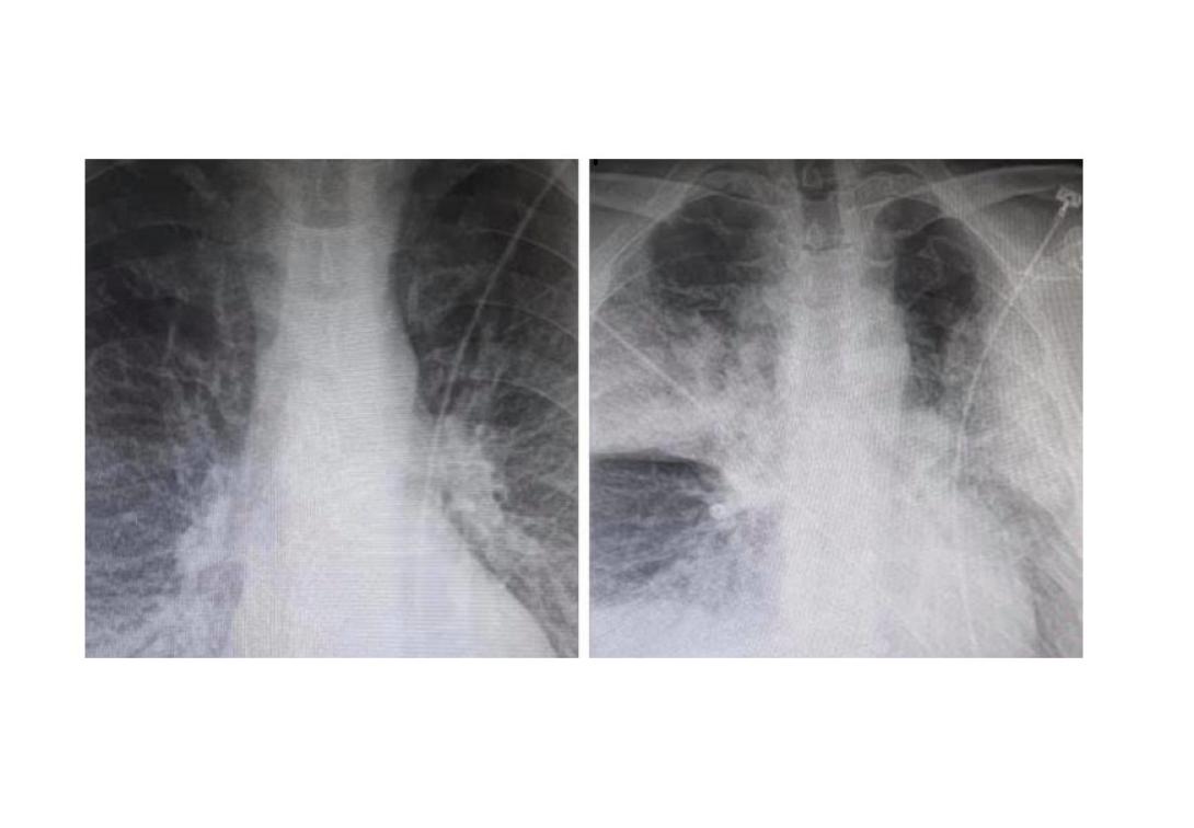 Ακτινογραφίες