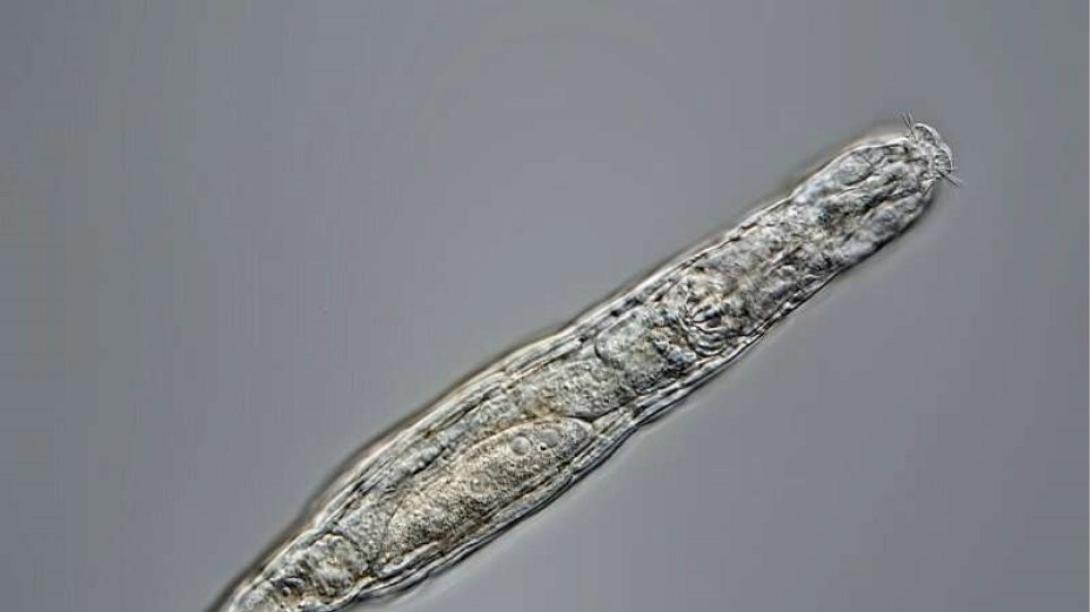 arctic-rotifer-lives-a.jpg