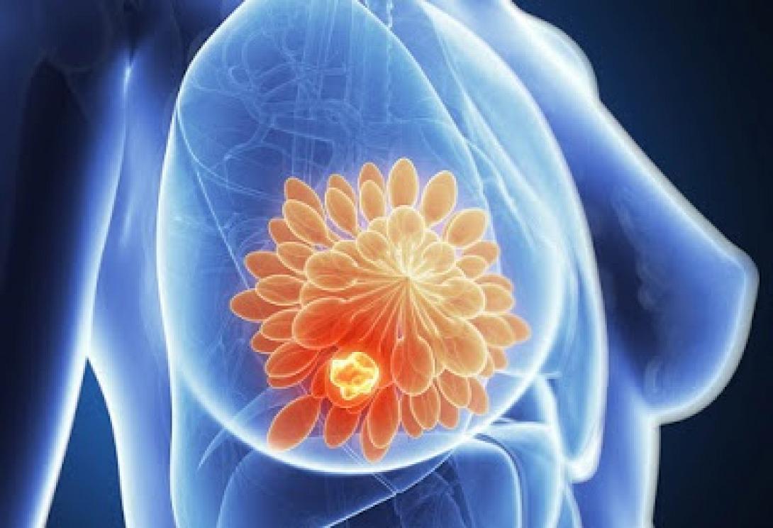 καρκινικός δείκτης