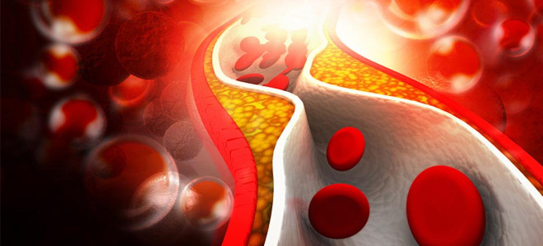 χοληστερινη