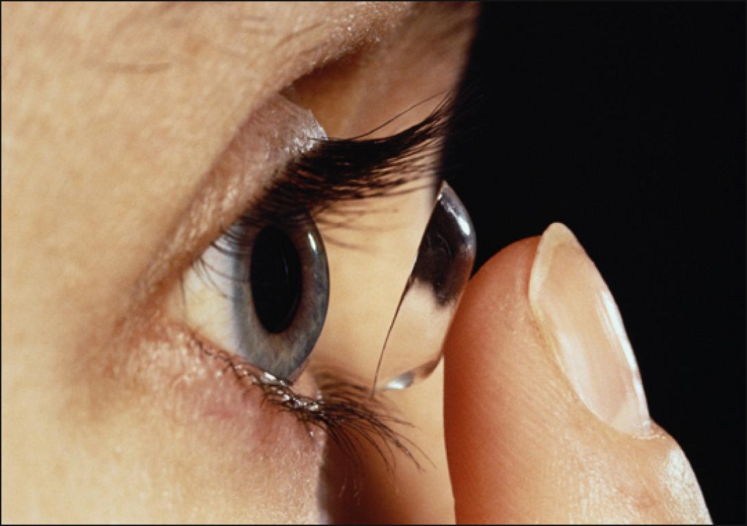 φακοι επαφης