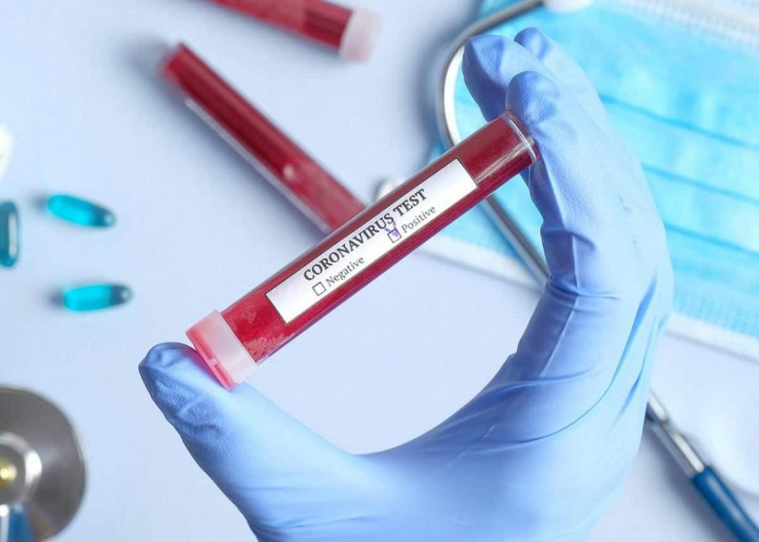 κορωνοϊός-τεστ