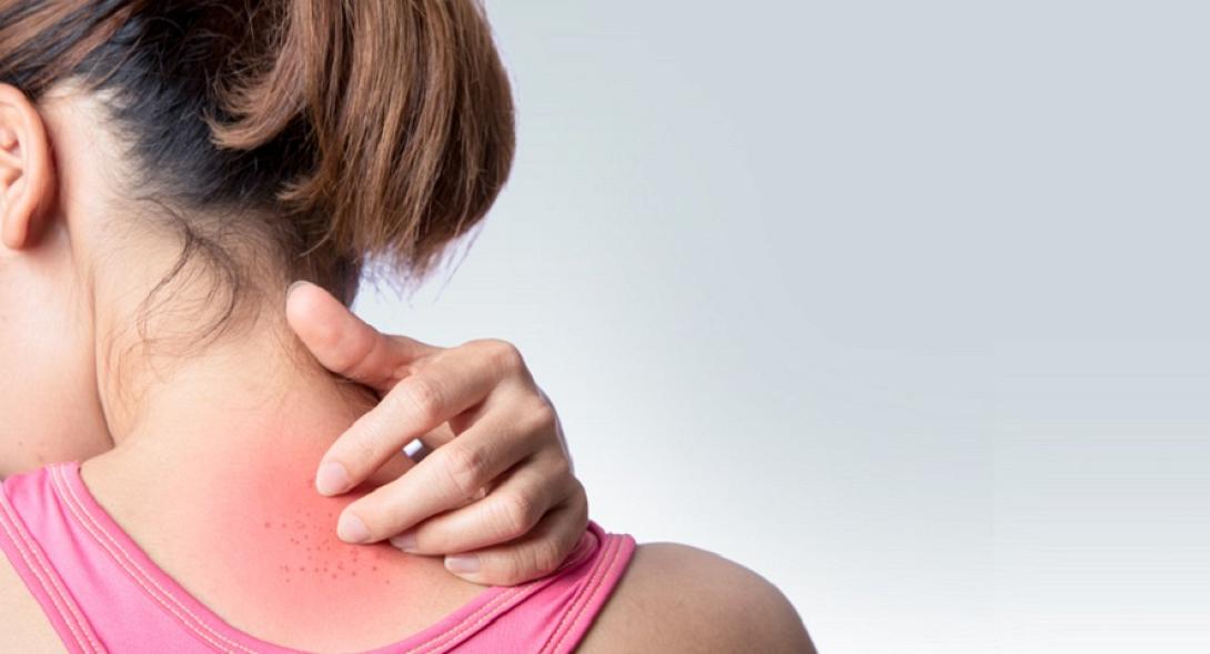 δερματίτιδα