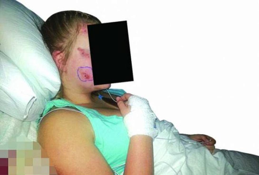 γυναίκα τσούχτρες