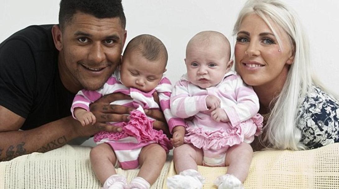 διδυμα Σκωτία