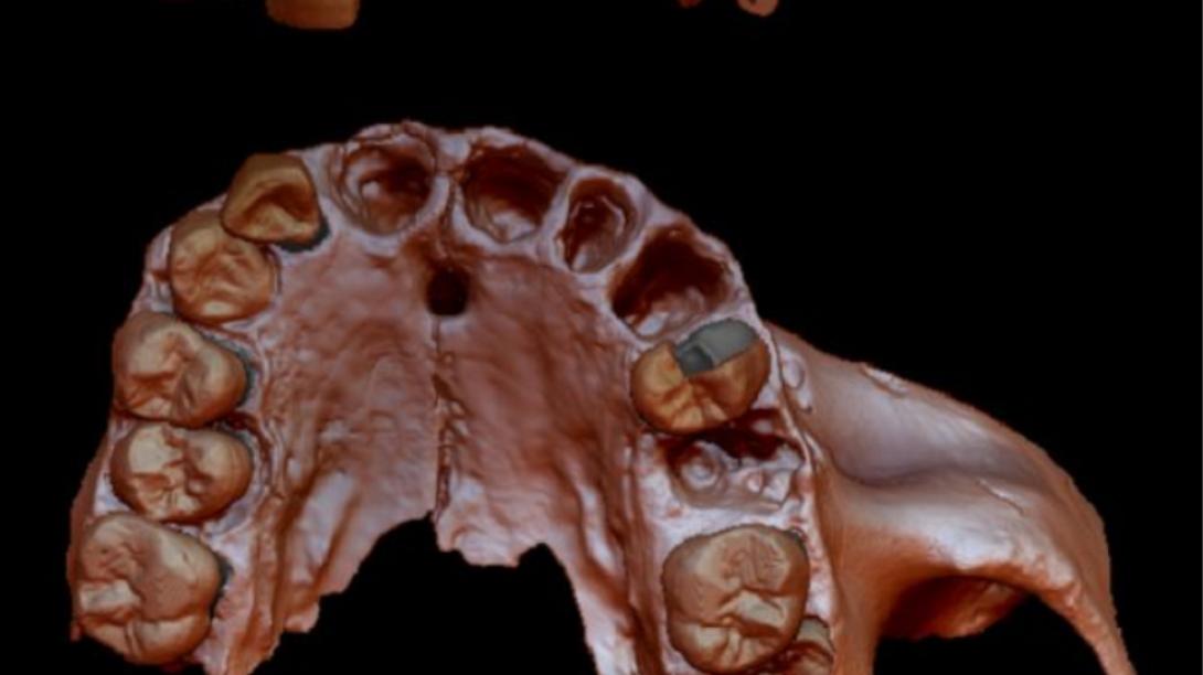 καννίβαλος δοντια