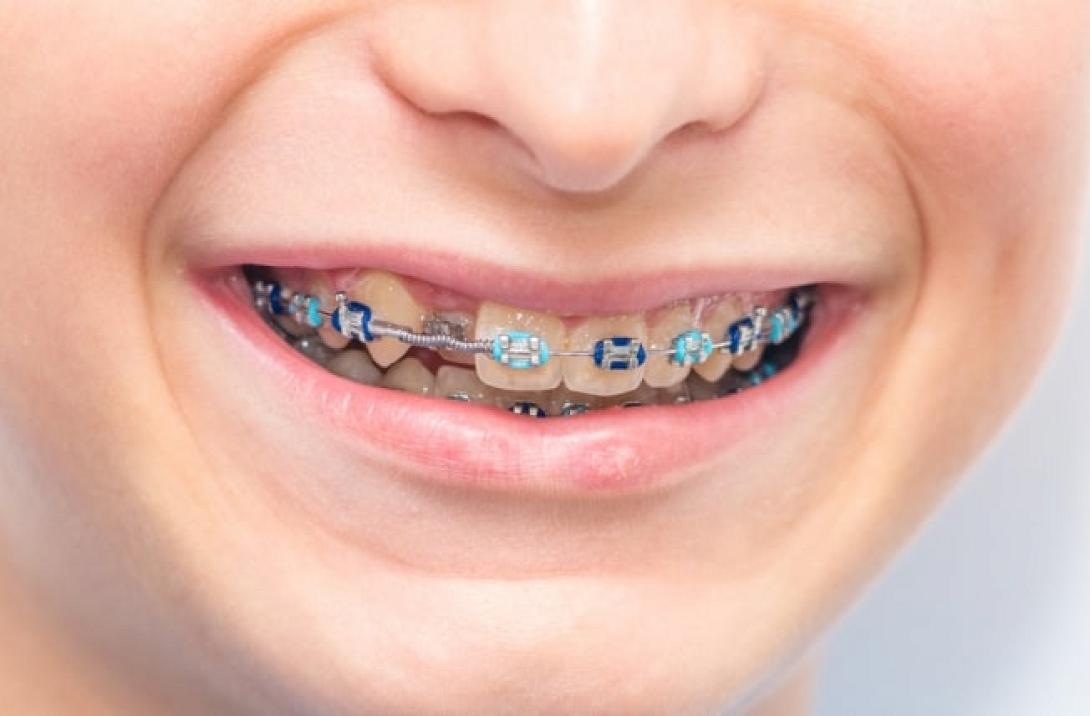 αυτοσχέδια οδοντιατρική