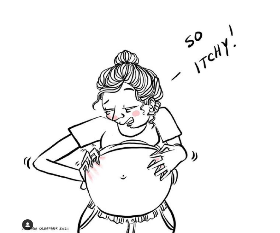 Σκίτσο εγκυμοσύνης