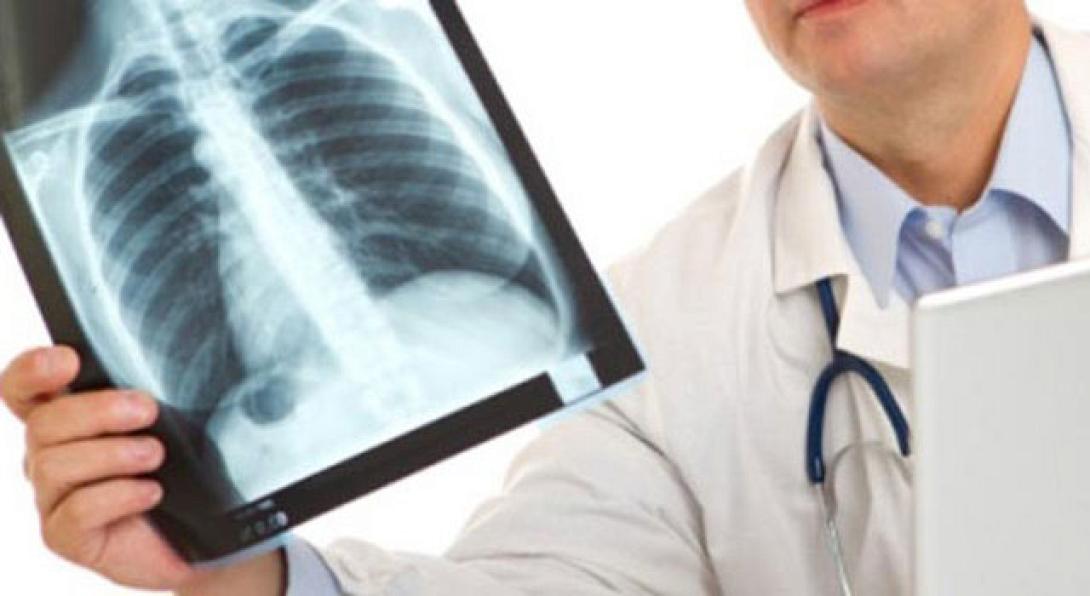 Κυρ. Στριγγάρης: Αναίτιες ακτινολογικές εξετάσεις εκτινάσσουν το κόστος