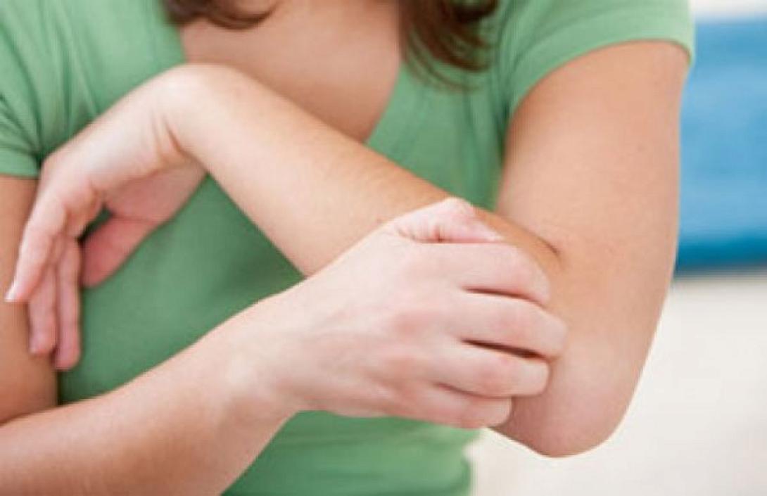 Αντιμετώπισε τη φαγούρα με υλικά από το σπίτι 