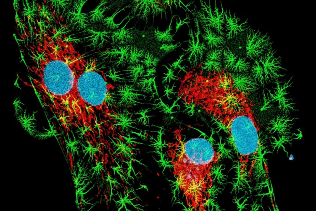 Νόμπελ Χημείας για την ανάπτυξη μικροσκοπίας φθορισμού 