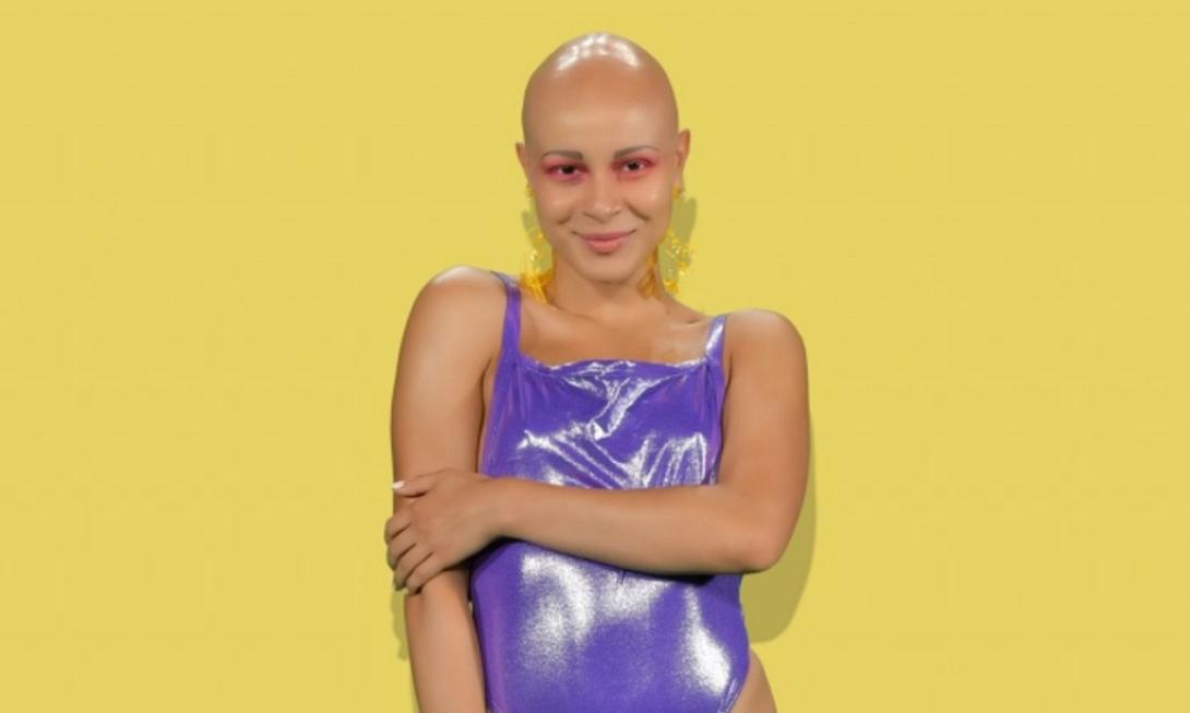 gntm-katsanikaki-alopekia.jpg