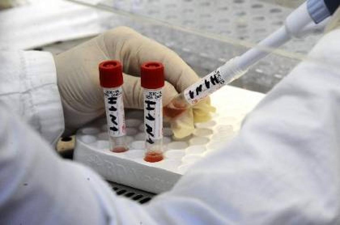 85 οι θάνατοι από γρίπη στην Ελλάδα