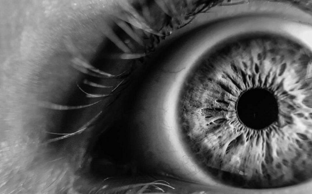 ώχρα κηλίδα