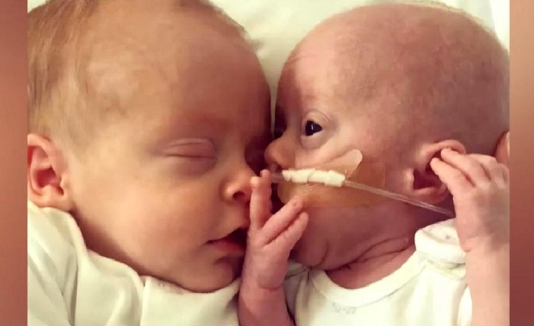 δίδυμα νεογέννητα