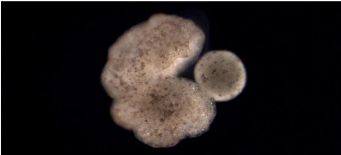 ΖΩΝΤΑΝΑ ΡΟΜΠΟΤ