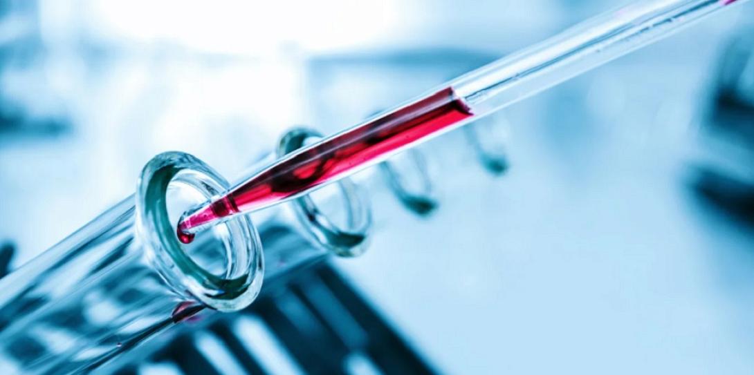 αιμα εργαστηριο