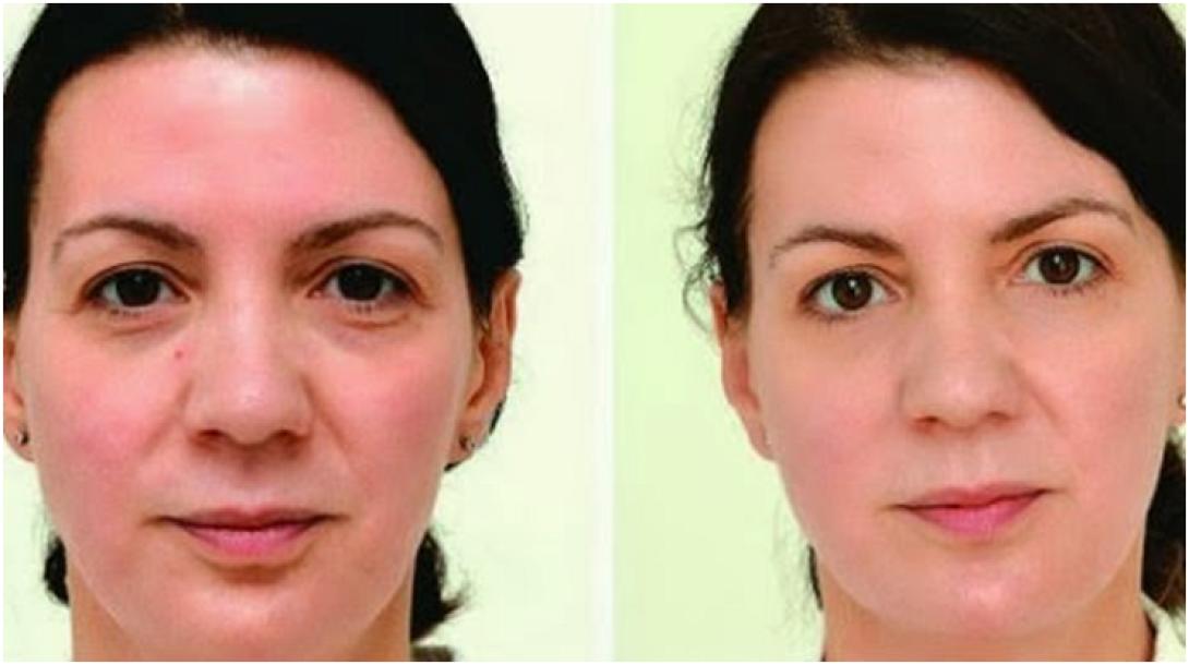 Οι θαυματουργές ιδιότητες του νερού!