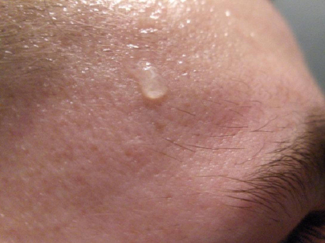 Εννέα απορίες για τον ιδρώτα και οι απαντήσεις τους