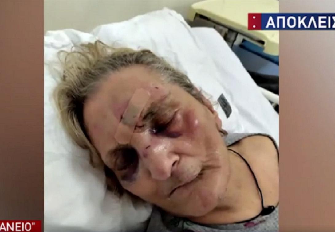 ηλικιωμένη ξυλοδαρμός