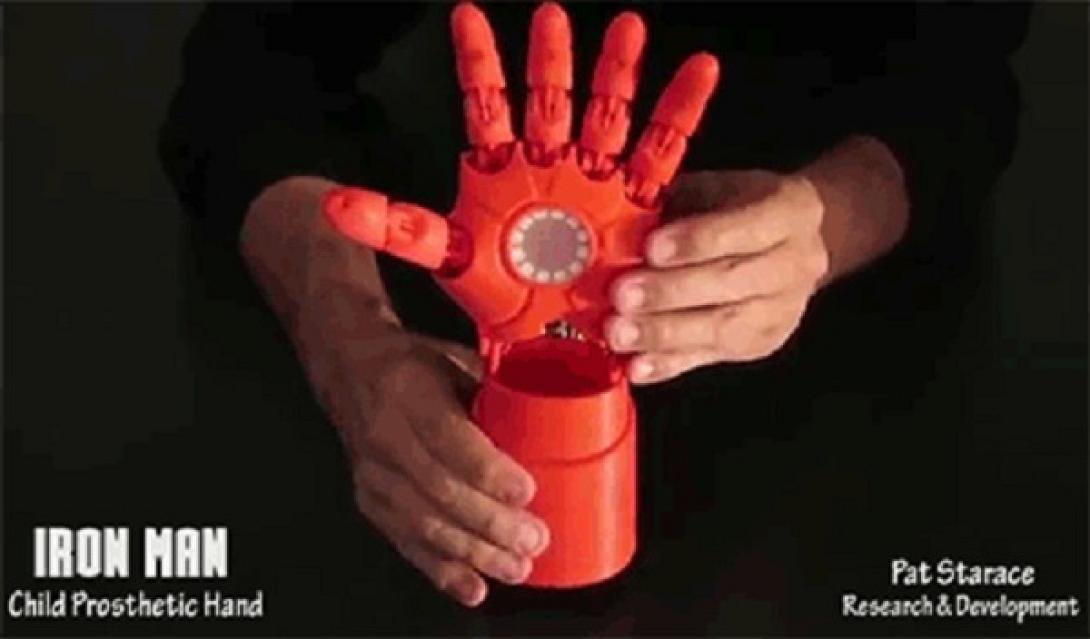Προσθετικό χέρι για παιδιά από εκτυπωτή 3D! (βίντεο)