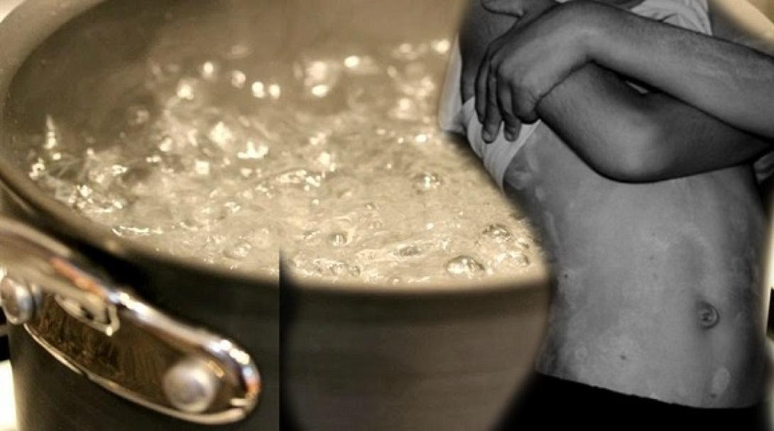 Από εγκαύματα ο θάνατος του 3χρονου αγοριού στη Μεσαρά - Ίχνη κακοποίησης βρήκε ο ιατροδικαστής