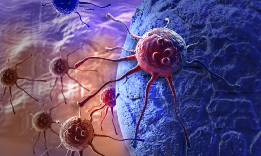 καρκίνους παχεως εντετρου