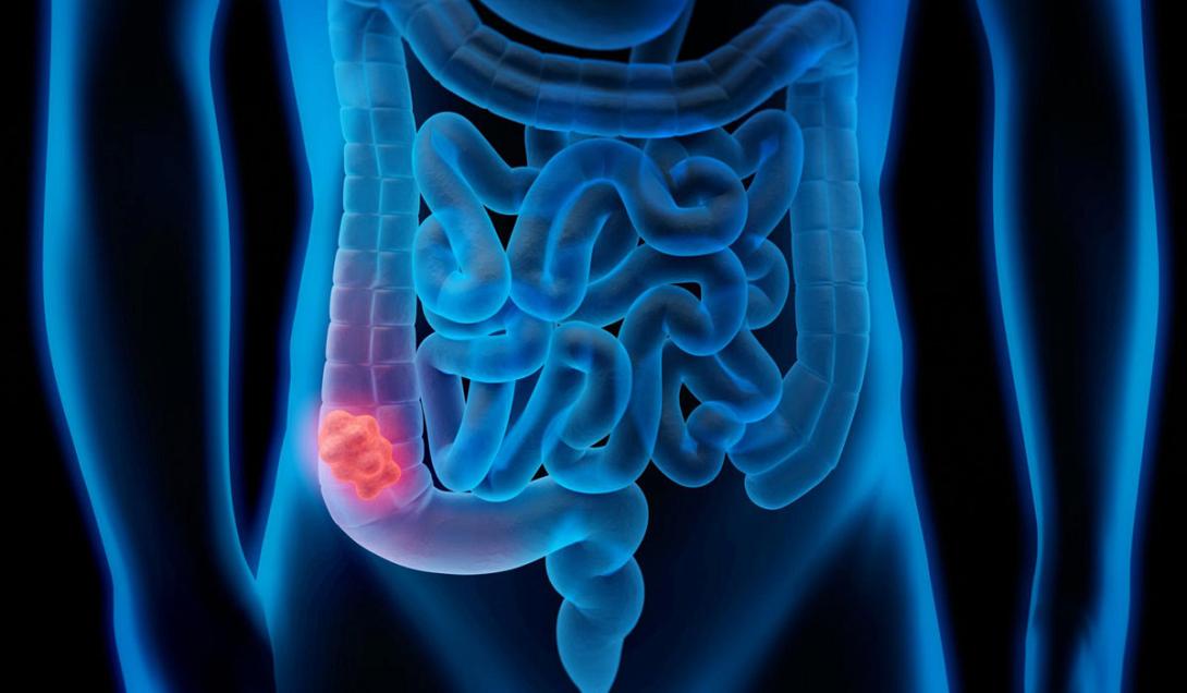 Παχύ Εντερο