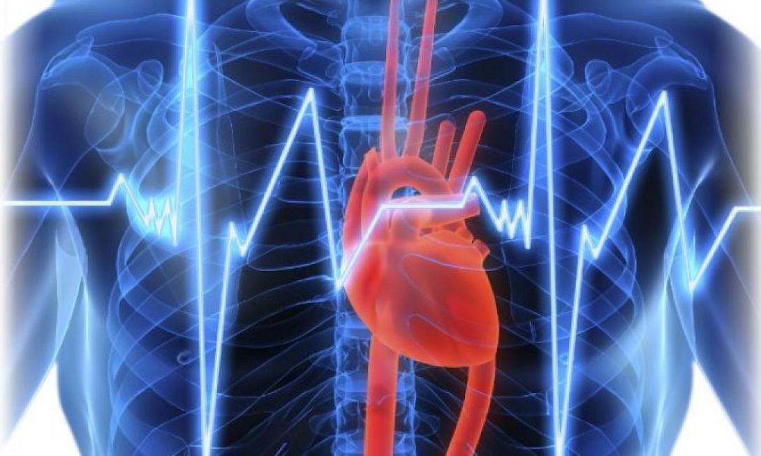 κολπική μαρμαρυγή