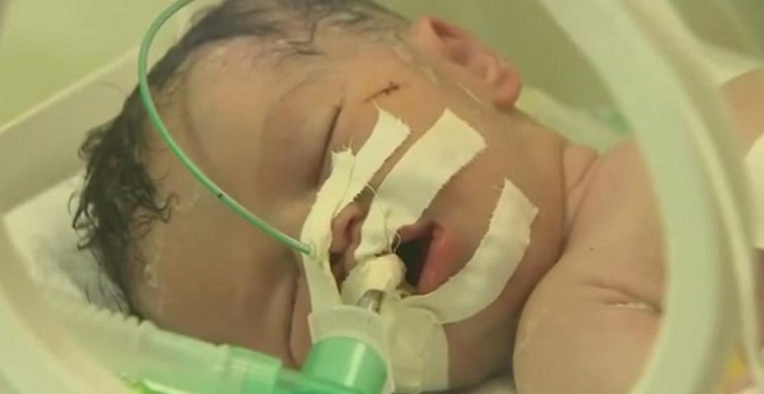 Κοριτσάκι ήρθε στη ζωή ενώ η μητέρα του "έφευγε" - Συγκλονιστικό βίντεο από τη Γάζα