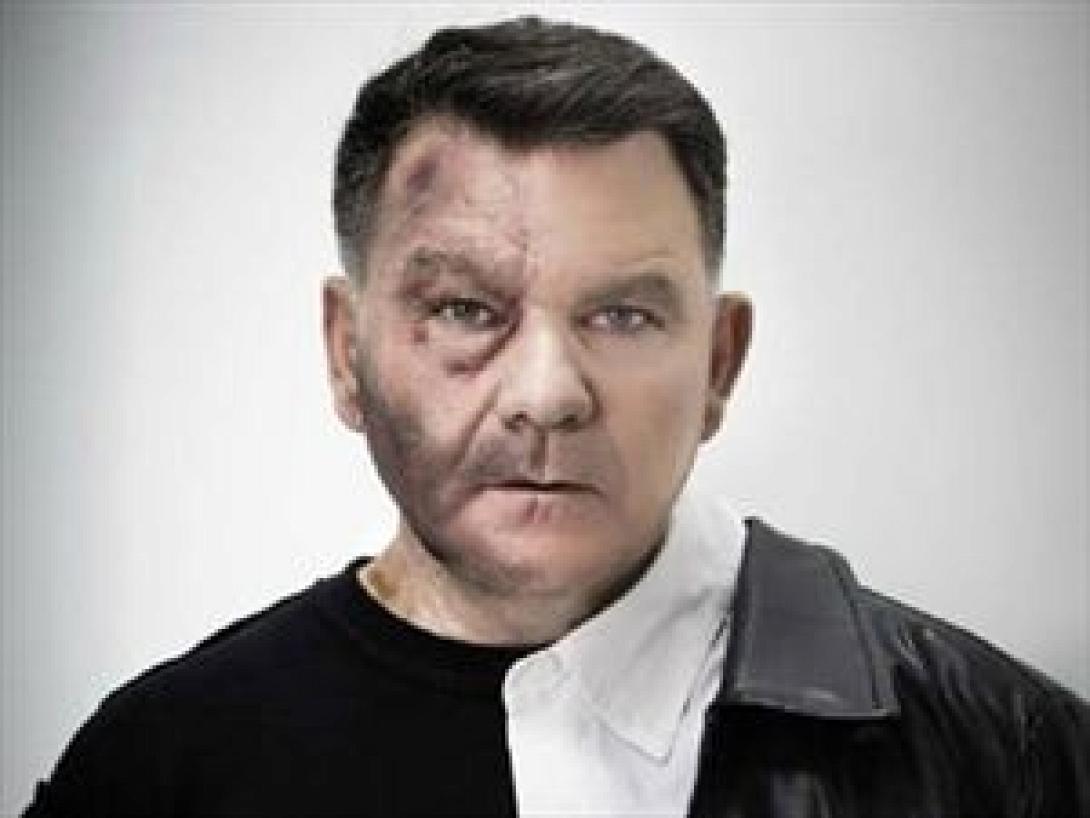 Επίθεση στον Κούγια με σιδερογροθιά