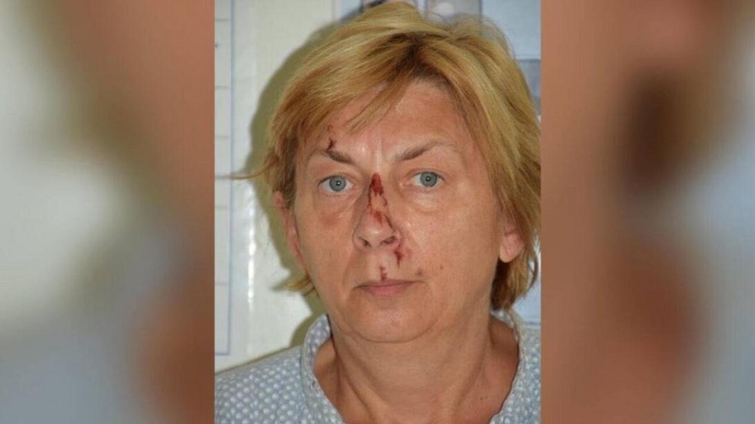 γυναικα κροατια