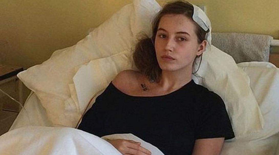 Ξύπνησε την ώρα που τη χειρουργούσαν στον εγκέφαλο, 19χρονη στην Πολωνία!