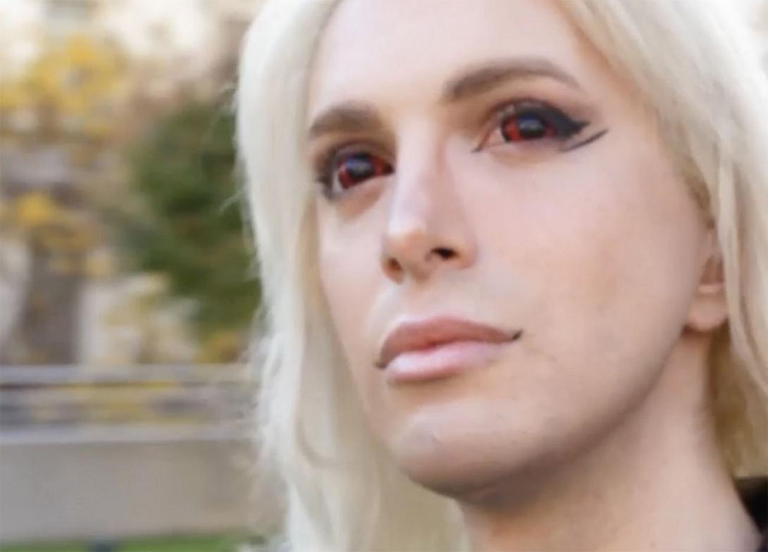 ο ανθρωπος με τις 32 πλαστικες