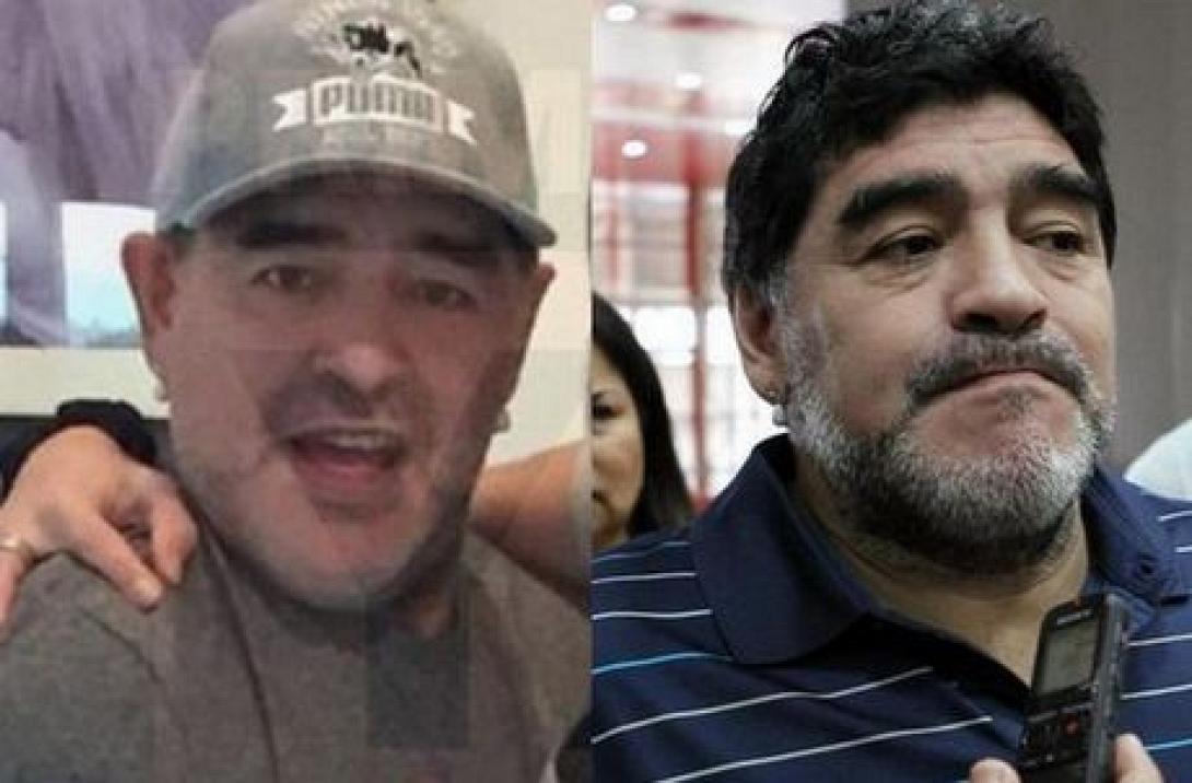Ο Μαραντόνα έκανε λίφτινγκ