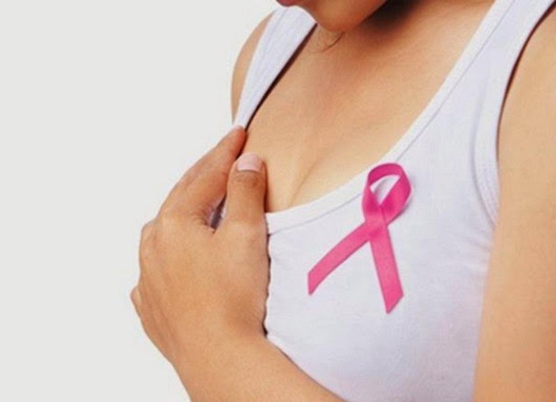 Η διπλή μαστεκτομή δεν αυξάνει τα χρόνια ζωής