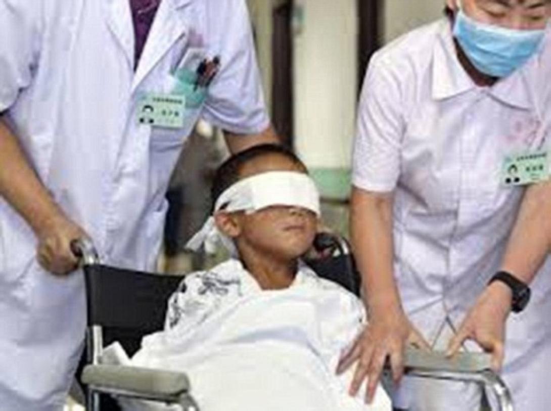 Απίστευτη ιστορία: Μητέρα στο Μεξικό έβγαλε τα μάτια του γιου της!