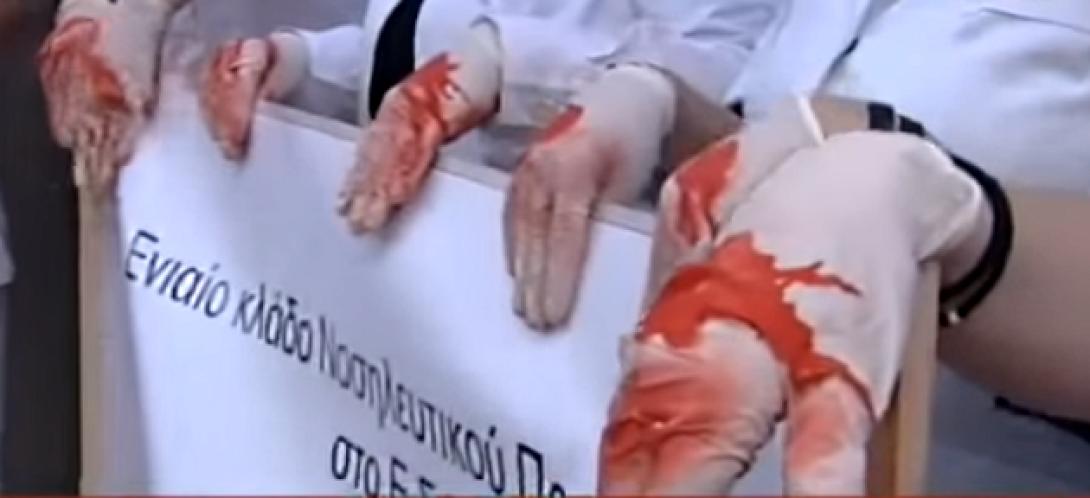 ματωμένα γάντια