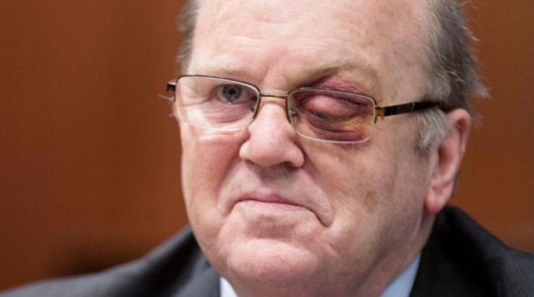 Με μαυρισμένο μάτι στο Eurogroup ο Ιρλανδός υπουργός Οικονομικών