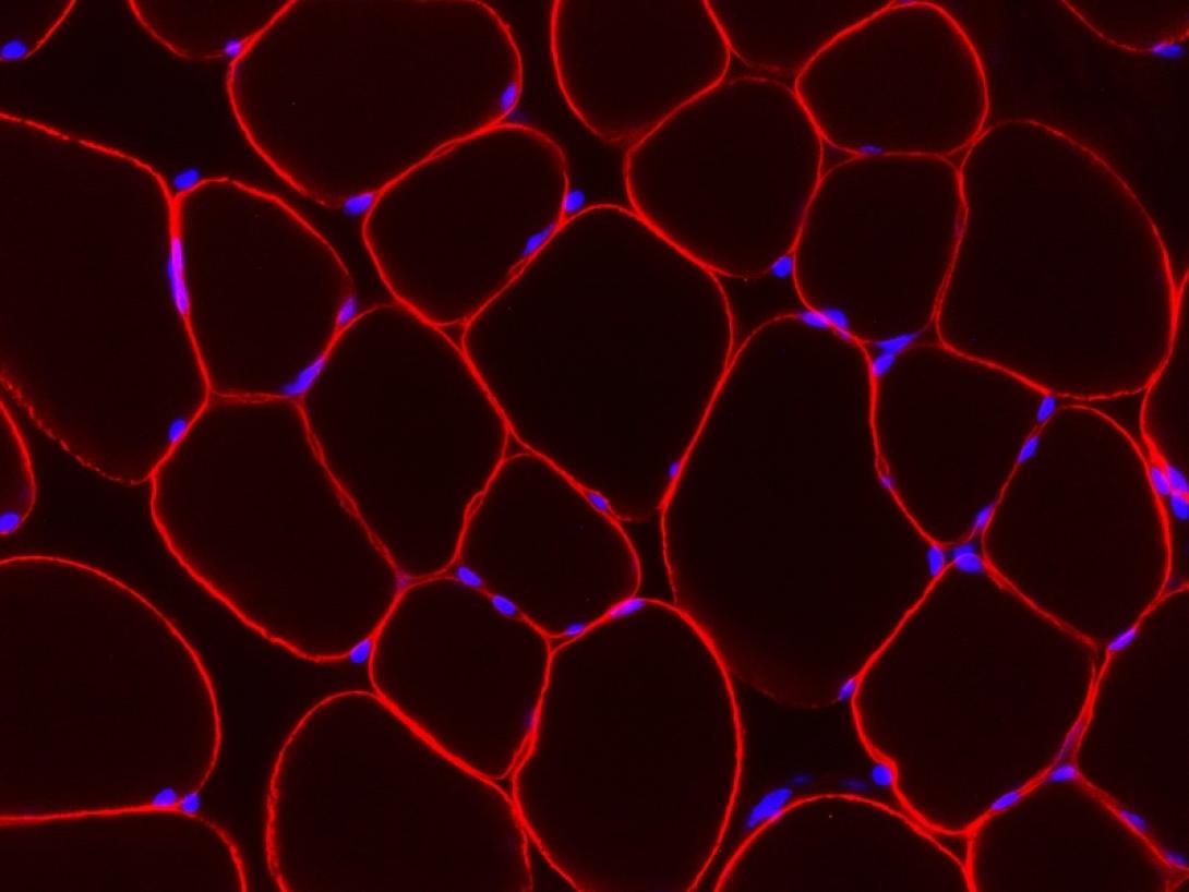 Δημιουργήθηκε στο εργαστήριο ανθρώπινος σκελετικός μυς που συσπάται σαν τον φυσικό